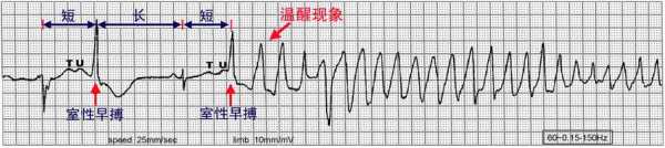 慢频率什么意思（什么是慢波）