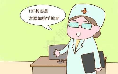 检TC挂什么科（做tct检查挂什么科）