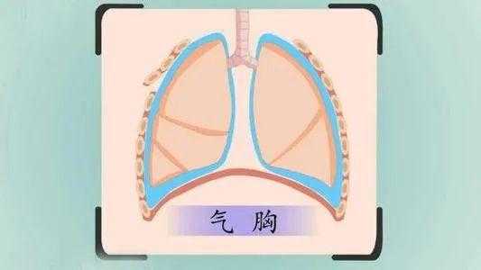 70-533是什么（7035是什么意思）