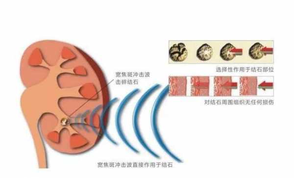 碎石超粒径有什么影响（碎石粒径范围）